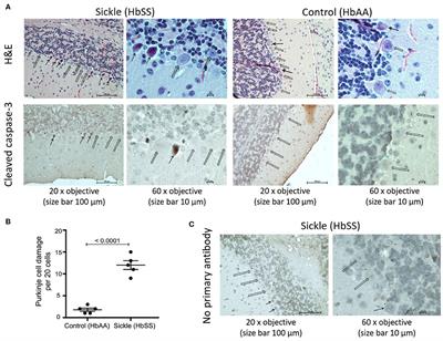 Spatiotemporal Alterations in Gait in Humanized Transgenic Sickle Mice